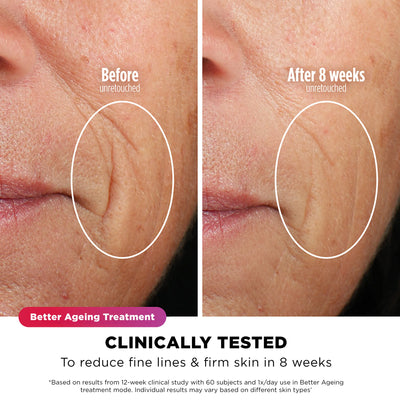 Ninja CryoGlow Under-Eye Cooling + LED Face Mask